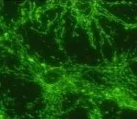 ICC/IF analysis of rat neuronal/glial cell culture using GTX25432 ATP5B antibody [4.3E8.D10].