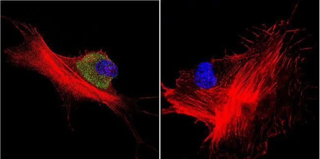ICC/IF analysis of NIH-3T3 cells using GTX25444 Hsp70 antibody [4G4]. Cells were probed without (right) or with(left) an antibody. Green : Primary antibody Blue : Nuclei Red : Actin Fixation : formaldehyde Dilution : 1:100 overnight at 4 oC