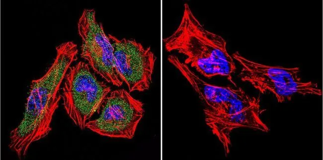 ICC/IF analysis of HeLa cells using GTX25444 Hsp70 antibody [4G4]. Cells were probed without (right) or with(left) an antibody. Green : Primary antibody Blue : Nuclei Red : Actin Fixation : formaldehyde Dilution : 1:100 overnight at 4 oC