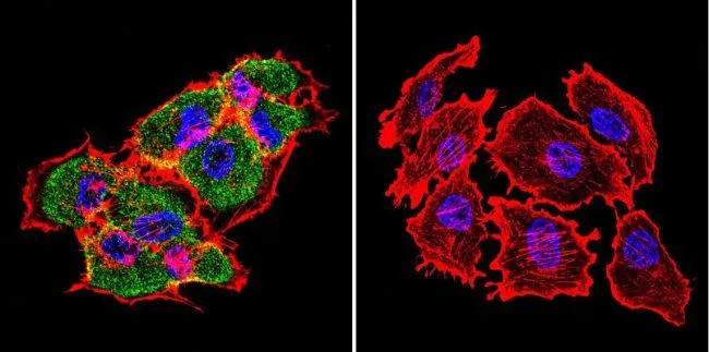 ICC/IF analysis of NIH-3T3 cells using GTX25444 Hsp70 antibody [4G4]. Cells were probed without (right) or with(left) an antibody. Green : Primary antibody Blue : Nuclei Red : Actin Fixation : formaldehyde Dilution : 1:100 overnight at 4 C