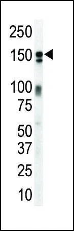 WB analysis of mouse brain lysate using GTX25470 Her3 / ErbB3 antibody. WB analysis of mouse brain lysate using GTX25470 Her3 / ErbB3 antibody.
