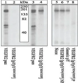 WB analysis of PAE cells transfected with a chimeric receptor unstimulated (Lane 1, 2) or stimulated with 40ng/mL CSF-1 for 10 minutes (Lane 3-8) using GTX25473 VEGF Receptor 2 (phospho Tyr1054/Tyr1059) antibody. WB analysis of PAE cells transfected with a chimeric receptor unstimulated (Lane 1, 2) or stimulated with 40ng/mL CSF-1 for 10 minutes (Lane 3-8) using GTX25473 VEGF Receptor 2 (phospho Tyr1054/Tyr1059) antibody.