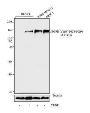 WB analysis of whole cell extracts (30 microg lysate) of HUVEC (Lane 1), treated with 25ng/mL VEGF for 5 minutes (lane 2), MDA-MB-231 (lane 3), and MCF7 (Lane 4) using GTX25473 VEGF Receptor 2 (phospho Tyr1054/Tyr1059) antibody. Dilution : 1:1000