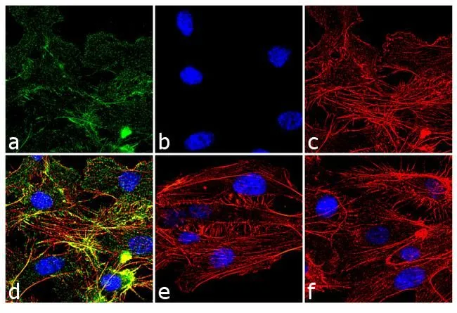 ICC/IF analysis of HUVEC cell treated with 100ng of VEGF for 30 minutes using GTX25473 VEGF Receptor 2 (phospho Tyr1054/Tyr1059) antibody. Panel e is untreated cell with no signal. Panel f represents control cells with no primary antibody to assess background. Green : Primary antibody Blue : Nuclei Red : Actin Fixation : 4% paraformaldehyde Permeabilization : 0.1% Triton X-100 for 10 minutes