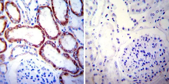 IHC-P analysis of human kidney tissue using GTX25479 HSP60 antibody [2E1/53]. Left : Primary antibody Right : Negative control without primary antibody Antigen retrieval : heat induced antigen retrieval was performed using 10mM sodium citrate (pH6.0) buffer, microwaved for 8-15 minutes Dilution : 1:100