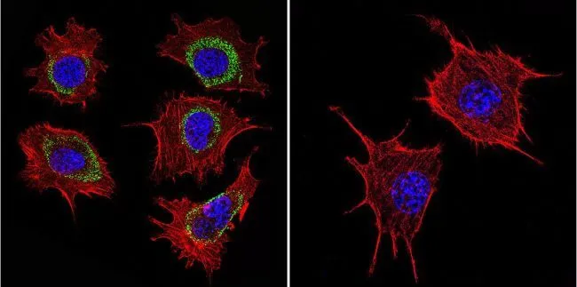 ICC/IF analysis of NIH-3T3 cells using GTX25479 HSP60 antibody [2E1/53]. Cells were probed without (left) or with(right) an antibody. Green : Primary antibody Blue : Nuclei Red : Actin Fixation : formaldehyde Dilution : 1:100 overnight at 4 oC