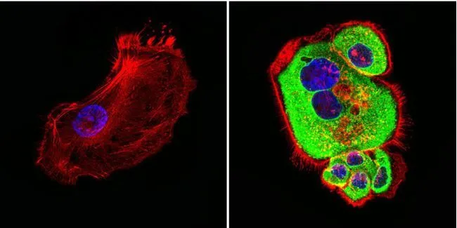 ICC/IF analysis of A431 cells using GTX25479 HSP60 antibody [2E1/53]. Cells were probed without (right) or with(left) an antibody. Green : Primary antibody Blue : Nuclei Red : Actin Fixation : Formalin Permeabilization : 0.1% Triton X-100 in TBS for 5-10 minute Dilution : 1:100 incubated overnight in a humidified chamber