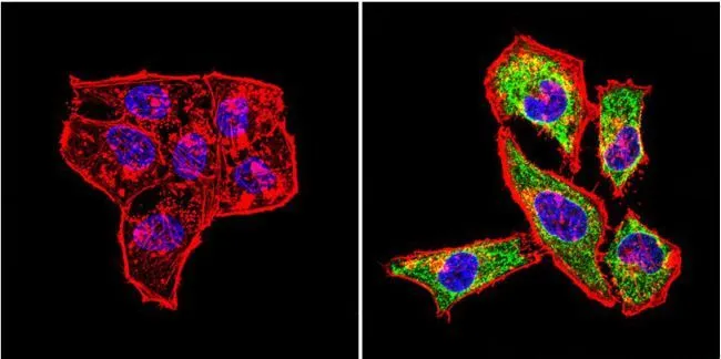 ICC/IF analysis of HeLa cells using GTX25479 HSP60 antibody [2E1/53]. Cells were probed without (right) or with(left) an antibody. Green : Primary antibody Blue : Nuclei Red : Actin Fixation : Formalin Permeabilization : 0.1% Triton X-100 in TBS for 5-10 minute Dilution : 1:200 and incubated overnight in a humidified chamber