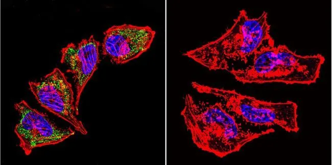 ICC/IF analysis of HeLa cells using GTX25479 HSP60 antibody [2E1/53]. Cells were probed without (right) or with(left) an antibody. Green : Primary antibody Blue : Nuclei Red : Actin Fixation : formaldehyde Dilution : 1:100 overnight at 4 oC