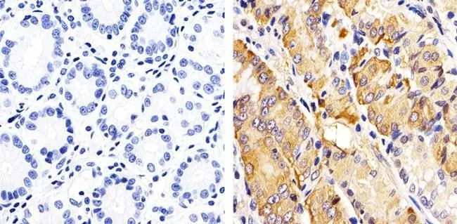 IHC-P analysis of human stomach tissue using GTX25482 RAC1 + CDC42 (phospho Ser71) antibody. Right : Primary antibody Left : Negative control without primary antibody Antigen retrieval : 10mM sodium citrate (pH 6.0), microwaved for 8-15 min Dilution : 1:20 IHC-P analysis of human stomach tissue using GTX25482 RAC1 + CDC42 (phospho Ser71) antibody. Right : Primary antibody Left : Negative control without primary antibody Antigen retrieval : 10mM sodium citrate (pH 6.0), microwaved for 8-15 min Dilution : 1:20
