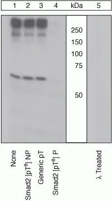 WB (peptide competition) analysis of HepG2 cells stimulated with TGF beta using GTX25487 SMAD2 (phospho Thr8) antibody prior incubated with the non-phosphopeptide corresponding to the immunogen (Lane 2), a generic phosphothreonine containing peptide (Lane 3), or, the phosphopeptide immunogen (Lane 4) control. The data show that only the immunogen phosphopeptide blocks the signal, demonstrating the specificity of the antibody. The membrane treated with phosphatase (Lane 5) eliminates the signal further verifying that the antibody is phospho-specific.