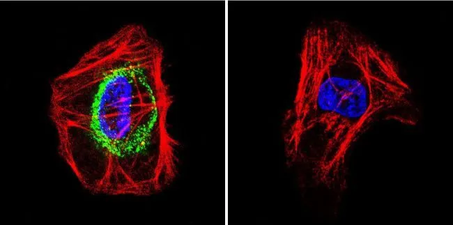 ICC/IF analysis of A431 cells using GTX25492 TSH receptor antibody [49]. Cells were probed without (right) or with(left) an antibody. Green : Primary antibody Blue : Nuclei Red : Actin Fixation : formaldehyde Dilution : 1:200 overnight at 4oC