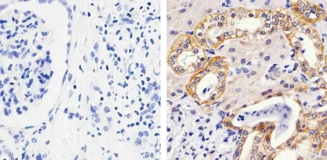 IHC-P analysis of human kidney tissue using GTX25612 MEK1 (phospho Thr292) antibody. Right : Primary antibody Left : Negative control without primary antibody Antigen retrieval : 10mM sodium citrate (pH 6.0), microwaved for 8-15 min Dilution : 1:100 IHC-P analysis of human kidney tissue using GTX25612 MEK1 (phospho Thr292) antibody. Right : Primary antibody Left : Negative control without primary antibody Antigen retrieval : 10mM sodium citrate (pH 6.0), microwaved for 8-15 min Dilution : 1:100