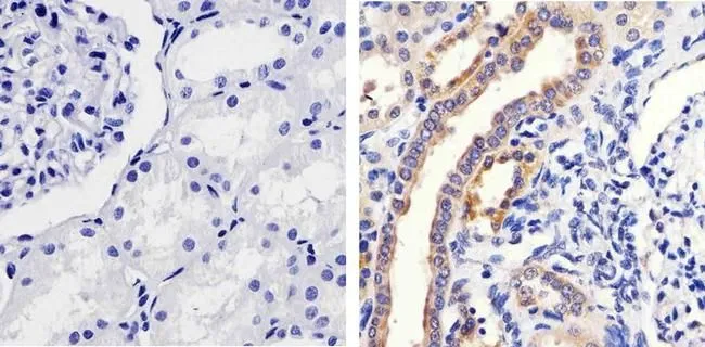 IHC-P analysis of human kidney tissue using GTX25613 MEK1 (phospho Ser298) antibody. Right : Primary antibody Left : Negative control without primary antibody Antigen retrieval : 10mM sodium citrate (pH 6.0), microwaved for 8-15 min Dilution : 1:100