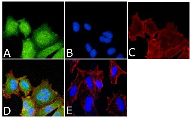 ICC/IF analysis of A549 cells using GTX25613 MEK1 (phospho Ser298) antibody. Panel e is a no primary antibody control. Green : Primary antibody Blue : Nuclei Red : Actin Fixation : 4% paraformaldehyde Permeabilization : 0.25% Triton X-100 for 10 minutes Dilution : 1:250 dilution in 1% BSA incubated for 3 hours at room temperature