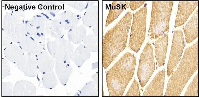 IHC-P analysis of mouse skeletal muscle tissue using GTX25619 MUSK antibody. Right : Primary antibody Left : Negative control without primary antibody Antigen retrieval : heat induced antigen retrieval was performed using 10mM sodium citrate (pH 6.0) buffer for 10 minutes using a microwave Permeabilization : TBS/0.025% Triton Dilution : 1:20