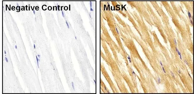IHC-P analysis of rat skeletal muscle tissue using GTX25619 MUSK antibody. Right : Primary antibody Left : Negative control without primary antibody Antigen retrieval : heat induced antigen retrieval was performed using 10mM sodium citrate (pH 6.0) buffer for 10 minutes using a microwave Permeabilization : TBS/0.025% Triton Dilution : 1:20