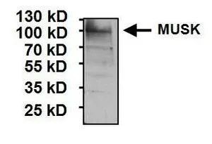 WB analysis of 30 ug of rat skeletal muscle tissue lysate using GTX25619 MUSK antibody. Dilution : 1 microg/ml