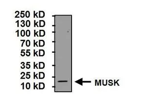 WB analysis of 3ng of muscle-specific kinase antigen using GTX25619 MUSK antibody. Dilution : 1 microg/ml