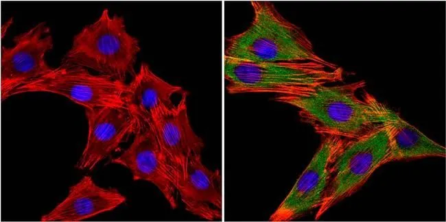 ICC/IF analysis of L6 cells using GTX25619 MUSK antibody. Cells were probed without (left) or with(right) an antibody. Green : Primary antibody Blue : Nuclei Red : Actin Fixation : 4% paraformaldehyde Permeabilization : 0.1% Triton X-100 in TBS for 10 minutes Dilution : 1:20 in blocking buffer for at least 1 hour at room temperature