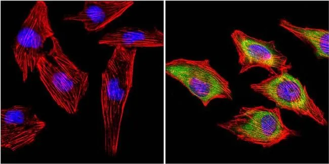 ICC/IF analysis of C2C12 cells using GTX25619 MUSK antibody. Cells were probed without (left) or with(right) an antibody. Green : Primary antibody Blue : Nuclei Red : Actin Fixation : 4% paraformaldehyde Permeabilization : 0.1% Triton X-100 in TBS for 10 minutes Dilution : 1:20 in blocking buffer for at least 1 hour at room temperature
