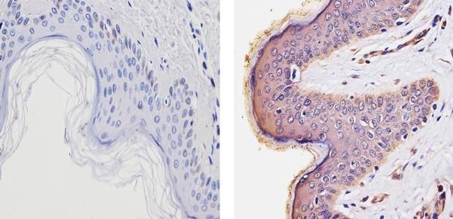 IHC-P analysis of human skin tissue using GTX25621 Thyroid Hormone Receptor alpha antibody. Right : Primary antibody Left : Negative control without primary antibody Antigen retrieval : 10mM sodium citrate (pH 6.0),microwaved for 8-15 min Dilution : 1:100