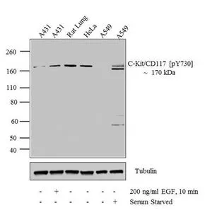 WB analysis of 30 microg of A431 (Lane 1) treated for 10 minutes with 200 ng/ml of EGF (Lane 2), Rat Lung (Lane 3), HeLa (Lane 4), A549 (Lane 5) and serum starved A549 (Lane 6) lysate using GTX25633 c-Kit (phospho Tyr730) antibody. Dilution : 1:1000