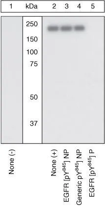 WB analysis of samples using GTX25636 EGFR (phospho Tyr845) antibody. The data show that only the immunogen phosphopeptide blocks the signal, demonstrating the specificity of the antibody. WB analysis of samples using GTX25636 EGFR (phospho Tyr845) antibody. The data show that only the immunogen phosphopeptide blocks the signal, demonstrating the specificity of the antibody.