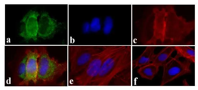 ICC/IF analysis of HeLa cells treated with EGF (200 ng/mL for 10 min) using GTX25636 EGFR (phospho Tyr845) antibody. Panel e is untreated cell with no signal. Panel f represents control cells with no primary antibody to assess background. Green : Primary antibody Blue : Nuclei Red : Actin Fixation : 4% paraformaldehyde Permeabilization : 0.25% Triton X-100 for 10 minutes
