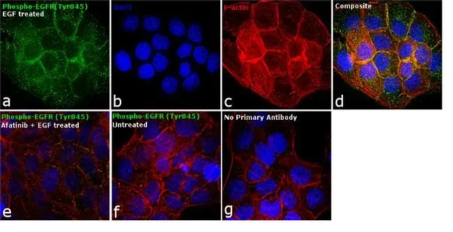 ICC/IF analysis of A431 cells treated with 200 ng/ml of EGF for 10 minutes using GTX25636 EGFR (phospho Tyr845) antibody. Green : Primary antibody Blue : Nuclei Red : Actin Fixation : 4% paraformaldehyde Permeabilization : 0.1% Triton X-100 for 10 minutes