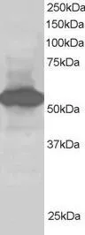 WB analysis of human kidney lysate using GTX25639 SIL1 antibody, C-term. Dilution : 1microg/ml Loading : 30microg protein in RIPA buffer WB analysis of human kidney lysate using GTX25639 SIL1 antibody, C-term. Dilution : 1microg/ml Loading : 30microg protein in RIPA buffer