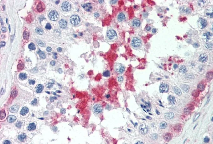 IHC-P analysis of human testis using GTX25639 SIL1 antibody, C-term. Antigen retrieval : citrate buffer pH 6 Dilution : 5microg/ml