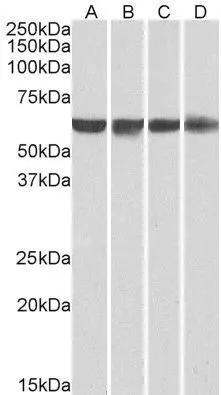 WB analysis of HeLa (A), HepG2 (B), Jurkat (C) and HEK293 (D) nuclear lysates using GTX25642 PTBP1 antibody, N-term. Dilution : 0.01microg/ml Loading : 35microg protein in RIPA buffer WB analysis of HeLa (A), HepG2 (B), Jurkat (C) and HEK293 (D) nuclear lysates using GTX25642 PTBP1 antibody, N-term. Dilution : 0.01microg/ml Loading : 35microg protein in RIPA buffer