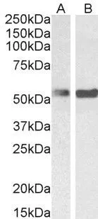 WB analysis of mouse ovary (A) and rat ovary (B) lysate using GTX25642 PTBP1 antibody, N-term. Dilution : 0.1-0.3microg/ml Loading : 35microg protein in RIPA buffer
