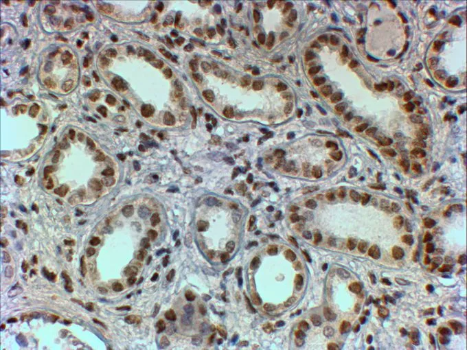 IHC-P analysis of human kidney using GTX25642 PTBP1 antibody, N-term. Antigen retrieval : Tris/EDTA buffer pH 9 Dilution : 2microg/ml