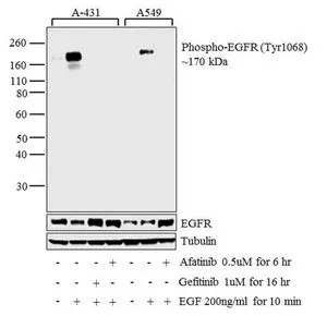 WB analysis of membrane enriched extracts (30 ug lysate) of A431 (Lane 1) treated with EGF (200ng/ml for 10 minutes) (Lane 2), A431 treated with Gefitinib followed by EGF (1uM for 16 hours, 200ng/ml for 10 minutes) (Lane 3), A431 treated with Afatinib followed by EGF (0.5 uM for 6 hours, 200ng/ml for 10 minutes) (Lane 4), A549 (Lane 5) treated with EGF (200ng/ml for 10 minutes) (Lane 6), and A549 treated with Afatinib followed by EGF (0.5 uM for 6 hours, 200ng/ml for 10 minutes) (Lane 7) using GTX25644 EGFR (phospho Tyr1068) antibody. Dilution : 1:1000