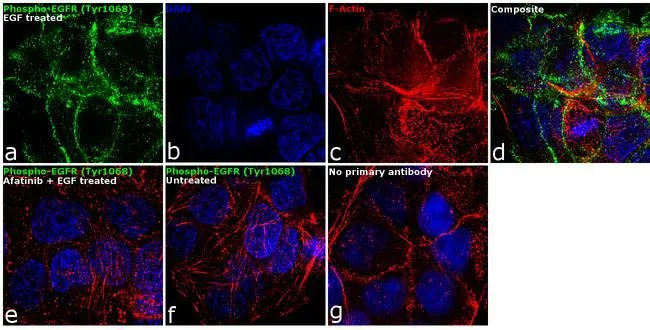 ICC/IF analysis of A431 cells treated with 200 ng/ml of EGF for 10 minutes using GTX25644 EGFR (phospho Tyr1068) antibody. Green : Primary antibody Blue : Nuclei Red : Actin Fixation : 4% paraformaldehyde Permeabilization : 0.1% Triton X-100 for 10 minutes