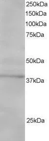 WB analysis of Jurkat lysate using GTX25645 SAE1 antibody,C-term. Dilution : 1ug/ml Loading : 30ug protein in RIPA buffer