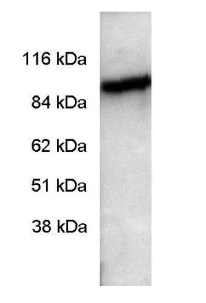 WB analysis of sheep retinal extracts using GTX25659 PDE6A antibody.
