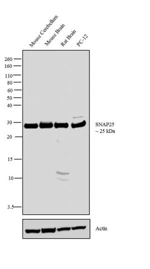 ICC/IF analysis of cultured rat hippocampal cells using GTX25666 SNAP25 antibody.