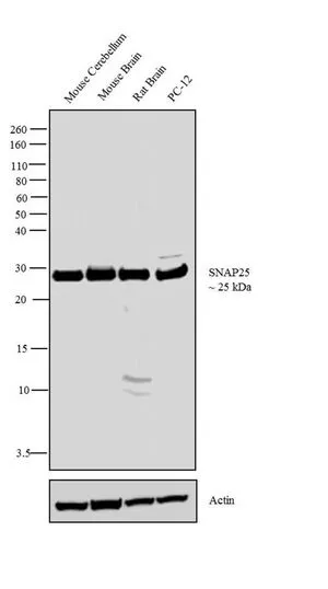 WB analysis of tissue extracts (30 microg lysate) of Mouse Cerebellum (Lane 1), Mouse Brain (Lane 2), Rat Brain (Lane 3) and membrane enriched extract (30 microg lysate) of PC-12 (Lane 4) using GTX25666 SNAP25 antibody. Dilution : 1 microg/ml WB analysis of tissue extracts (30 microg lysate) of Mouse Cerebellum (Lane 1), Mouse Brain (Lane 2), Rat Brain (Lane 3) and membrane enriched extract (30 microg lysate) of PC-12 (Lane 4) using GTX25666 SNAP25 antibody. Dilution : 1 microg/ml