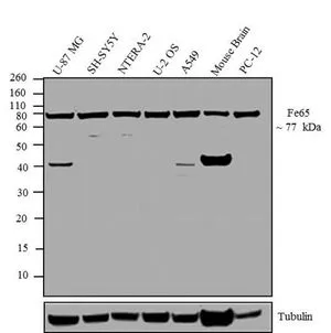 WB analysis of membrane enriched extracts (30 microg lysate) of U-87 MG (Lane 1), SH-SY5Y (Lane 2), NTERA-2 (Lane 3), U-2 OS (Lane 4), A549 (Lane 5), Mouse Brain (Lane 6) and PC-12 (Lane 7) using GTX25668 FE65 antibody. Dilution : 1-2 microg/ml WB analysis of membrane enriched extracts (30 microg lysate) of U-87 MG (Lane 1), SH-SY5Y (Lane 2), NTERA-2 (Lane 3), U-2 OS (Lane 4), A549 (Lane 5), Mouse Brain (Lane 6) and PC-12 (Lane 7) using GTX25668 FE65 antibody. Dilution : 1-2 microg/ml