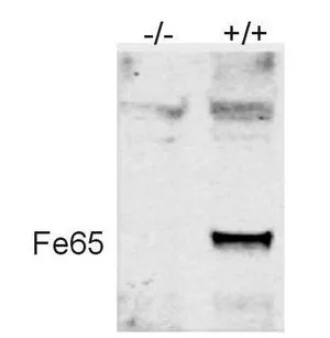 WB analysis of pulldown material form mouse brain lysate using GTX25668 FE65 antibody. Lane 1 : an immunopurified sample from a full-length Fe65 Knockout mouse Lane 2 : an immunopurified sample from an Fe65 wild type mouse