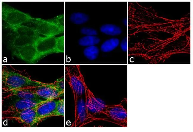 ICC/IF analysis of SH-SY5Y cells using GTX25668 FE65 antibody. Panel e is a no primary antibody control. Green : Primary antibody Blue : Nuclei Red : Actin Fixation : 4% paraformaldehyde Permeabilization : 0.1% Triton X-100 for 10 minute Dilution : 2 microg/ml in 0.1% BSA and incubated for 3 hours at room temperature