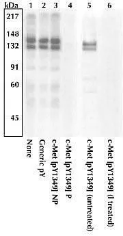 WB analysis of 293T cells expressing human c-Met and stimulated with HGF using GTX25669 c-Met (phospho Tyr1349) antibody. WB analysis of 293T cells expressing human c-Met and stimulated with HGF using GTX25669 c-Met (phospho Tyr1349) antibody.