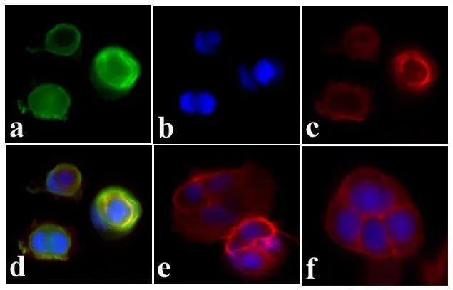 ICC/IF analysis of MCF-7 cells with insulin treatment (100nM for 5 min) using GTX25678 Insulin Receptor beta (phospho Tyr960) antibody. Panel e is untreated cell with no signal. Panel f represents control cells with no primary antibody to assess background. Green : Primary antibody Blue : Nuclei Red : Actin Fixation : 4% paraformaldehyde Permeabilization : 0.25% Triton X-100 for 10 minutes