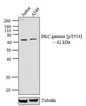 WB analysis of whole cell extracts (30 microg lysate) of Jurkat (Lane 1) and A549 (Lane 2) using GTX25778 PKC gamma (phospho Thr514) antibody. Dilution : 1:500