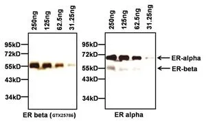 WB analysis of full-length human ER alpha recombinant protein and ER beta protein using GTX25786 Estrogen Receptor beta antibody at 1:1000 (left panel) or Estrogen Receptor alpha antibody (right panel).