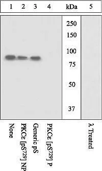 WB analysis of K562 cells stimulated with PMA using GTX25811 PKC epsilon (phospho Ser729) antibody. The membrane treated with phosphatase (Lane 5) eliminates the signal verifying that the antibody is phospho-specific. WB analysis of K562 cells stimulated with PMA using GTX25811 PKC epsilon (phospho Ser729) antibody. The membrane treated with phosphatase (Lane 5) eliminates the signal verifying that the antibody is phospho-specific.