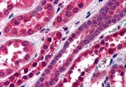 IHC-P analysis of human kidney using GTX25899 Amisyn antibody, N-term. Antigen retrieval : citrate buffer pH 6 Dilution : 3.8microg/ml IHC-P analysis of human kidney using GTX25899 Amisyn antibody, N-term. Antigen retrieval : citrate buffer pH 6 Dilution : 3.8microg/ml